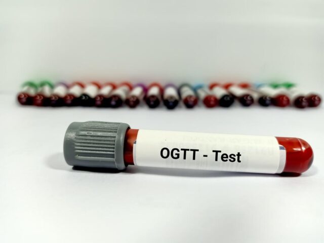 Ogtt test price in Bangladesh