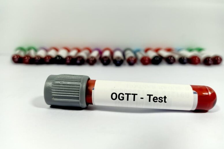 Ogtt test price in Bangladesh